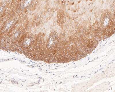 Immunohistochemistry-Paraffin: Cytokeratin 5/6 Antibody (A2A12) [NBP2-80401] - Analysis in human esophagus tissue using Cytokeratin 6a antibody. The section was pre-treated using heat mediated antigen retrieval with Tris-EDTA buffer (pH 8.0-8.4) for 20 minutes. The tissues were blocked in 5% BSA for 30 minutes at room temperature, w