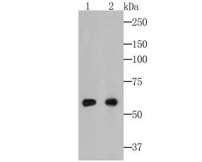 Western Blot: Cytokeratin 5/6 Antibody (A2A12) [NBP2-80401] - Analysis of Cytokeratin 6a on different lysates. Proteins were transferred to a PVDF membrane and blocked with 5% BSA in PBS for 1 hour at room temperature. The primary antibody (NBP2-80401, 1/100) was used in 5% BSA at room temperature for 2 hours. Goat Anti-Mouse IgG - HRP Secondary Antibody at 1:5,000 dilution was used for 1 hour at room temperature.Positive control: Lane 1: HT-29 cell lysateLane 2: Human skin tissue lysate