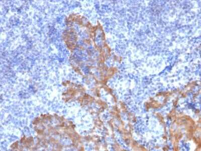 Immunohistochemistry-Paraffin: Cytokeratin 5/6 Antibody (KRT5.6/2438) [NBP3-07628] - Formalin-fixed, paraffin-embedded human Tonsil stained with Cytokeratin 5/6 Mouse Monoclonal Antibody (KRT5.6/2438).