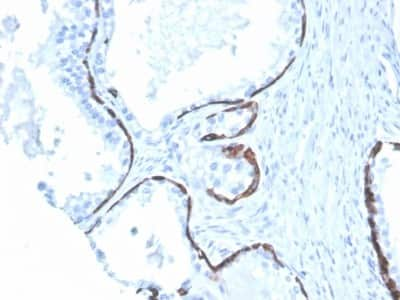 Immunohistochemistry-Paraffin: Cytokeratin 5/6 Antibody (KRT5.6/4866) [NBP3-07646] - Formalin-fixed, paraffin-embedded human prostate stained with Cytokeratin 5/6 Mouse Monoclonal Antibody (KRT5.6/4866).