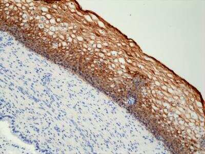 Immunohistochemistry-Paraffin: Cytokeratin 5/6 Antibody (RM341) [NBP2-77439] - Immunohistochemical staining of formalin fixed and paraffin embedded human cervix tissue section using anti-CK-5/CK-6 rabbit monoclonal antibody (Clone RM341) at a 1:1000 dilution.