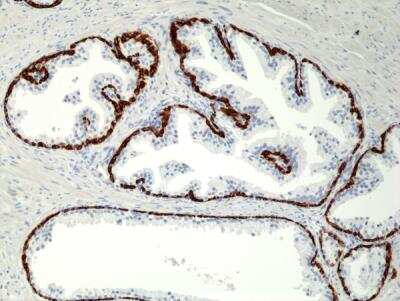 Immunohistochemistry-Paraffin: Cytokeratin 5/6 Antibody (RM341) [NBP2-77439] - Immunohistochemical staining of formalin fixed and paraffin embedded human Prostate tissue section using anti-CK-5/CK-6 rabbit monoclonal antibody (Clone RM341) at a 1:1000 dilution.