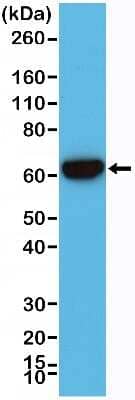 Western Blot: Cytokeratin 5/6 Antibody (RM341) [NBP2-77439] - Western Blot of A431 cell lysates using NBP2-77439.