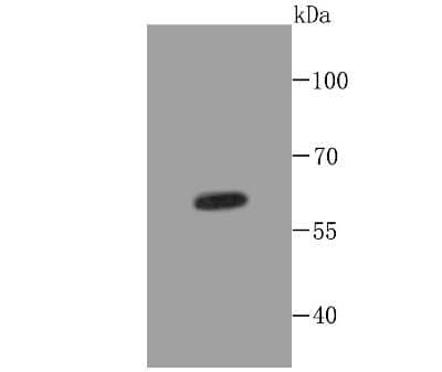 Western Blot: Cytokeratin 5/75 Antibody (SY88-19) [NBP2-67027] - Analysis of Cytokeratin 5 on A431 cell lysates using anti-Cytokeratin 5 at 1/500 dilution.
