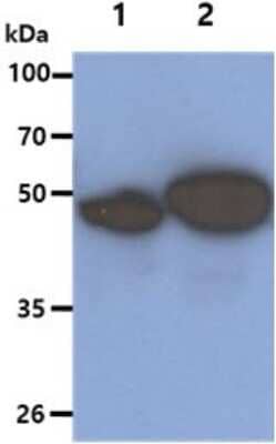 Western Blot: Cytokeratin 5 Antibody (12C4) [NBP2-59447] - Lane 1: HeLa cell lysates, Lane 2: A431 cell lysates