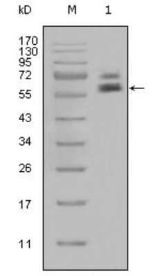 Western Blot: Cytokeratin 5 Antibody (1E1) [NBP1-47432] - Western blot analysis using anti-CK5 monoclonal antibody against Hela cell lysate(1).