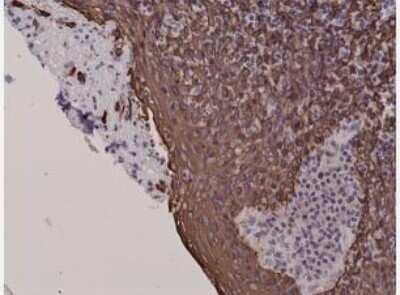Immunohistochemistry-Paraffin: Cytokeratin 5 Antibody (RM226) [NBP2-61524] - Immunohistochemical staining of formalin fixed and paraffin embedded human tonsil tissue sections.