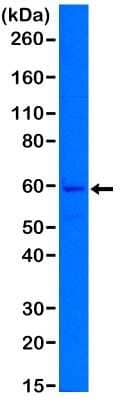 Western Blot: Cytokeratin 5 Antibody (RM226) [NBP2-61524] - Western Blot of A431 cell lysates using NBP2-61524, showed a band of Cytokeratin 5 expressed in A431 cells.