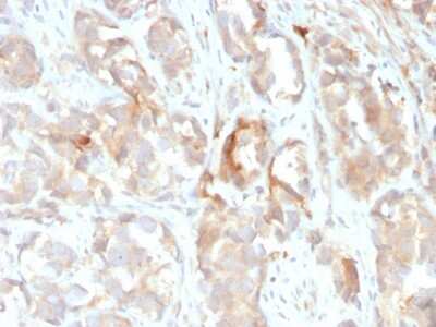 Immunohistochemistry-Paraffin: Cytokeratin 6 Antibody (KRT6B/2116) - Azide and BSA Free [NBP3-08612] - Formalin-fixed, paraffin-embedded human prostate stained with Cytokeratin 6 Monoclonal Antibody (KRT6B/2116).