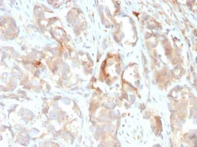 Immunohistochemistry-Paraffin: Cytokeratin 6 Antibody (KRT6B/2116) [NBP3-07798] - Formalin-fixed, paraffin-embedded human prostate stained with Cytokeratin 6 Monoclonal Antibody (KRT6B/2116).