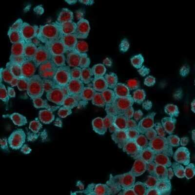 Immunocytochemistry/Immunofluorescence: Cytokeratin 6 Antibody (SPM269) - Azide and BSA Free [NBP2-34406] - Immunofluorescence Analysis of RAW cells labeling KRT6 with Cytokeratin 6 Antibody (SPM269) followed by Goat anti-Mouse IgG-CF488 (Cyan). The nuclear counterstain is Red Dot (Red).