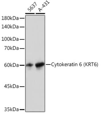 Western Blot: Cytokeratin 6a Antibody (1T4Z8) [NBP3-16452] - Western blot analysis of extracts of various cell lines, using Cytokeratin 6a (KRT6) Rabbit mAb (NBP3-16452) at 1:3000 dilution. Secondary antibody: HRP Goat Anti-Rabbit IgG (H+L) at 1:10000 dilution. Lysates/proteins: 25ug per lane. Blocking buffer: 3% nonfat dry milk in TBST. Detection: ECL Basic Kit. Exposure time: 1s.