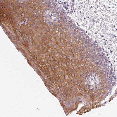 Immunohistochemistry-Paraffin: Cytokeratin 6a Antibody [NBP2-49325] - Staining of human oral mucosa shows moderate cytoplasmic and membranous positivity in squamous epithelial cells.