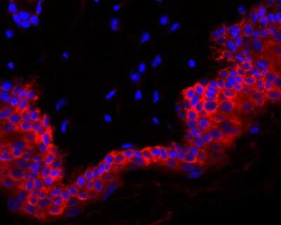 Immunohistochemistry-Paraffin: Cytokeratin 6a Antibody (SN71-07) [NBP2-67705] - Immunofluorescence analysis of paraffin-embedded rat skin tissue labeling Cytokeratin 6a (washed with PBS). And then probed with the primary antibodies Cytokeratin 6 (red) at 1/50 dilution at +4 overnight, washed with PBS. Goat Anti-Rabbit IgG H&L (iFluor(TM) 594) was used as the secondary antibodies at 1/1,000 dilution. Nuclei were counterstained with DAPI (blue).