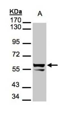 Western Blot: Cytokeratin 6a Antibody [NBP1-31443] - Sample(30 ug of whole cell lysate) A:A431 7.5% SDS PAGE, antibody diluted at 1:1000.