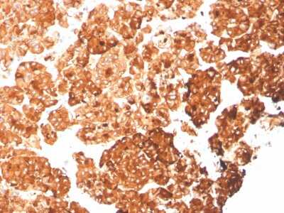 Immunohistochemistry-Paraffin: Cytokeratin 6a Antibody (rKRT6A/2100) - Azide and BSA Free [NBP3-08749] - Formalin-fixed, paraffin-embedded human pancreas stained with Cytokeratin 6a Recombinant Mouse Monoclonal Antibody (rCytokeratin 6a/2100).