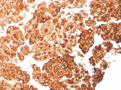 Immunohistochemistry-Paraffin: Cytokeratin 6a Antibody (rKRT6A/2100) [NBP3-07715] - Formalin-fixed, paraffin-embedded human pancreas stained with Cytokeratin 6a Recombinant Mouse Monoclonal Antibody (rCytokeratin 6a/2100).