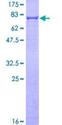 SDS-Page: Cytokeratin 6a Recombinant Protein [H00003853-P01]