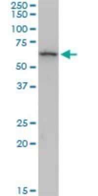 Western Blot: Cytokeratin 6b Antibody (1C12) [H00003854-M04] - Analysis of KRT6B expression in A-431.