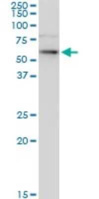 Western Blot: Cytokeratin 6b Antibody (1C4) [H00003854-M03] - Analysis of KRT6B expression in A-431.