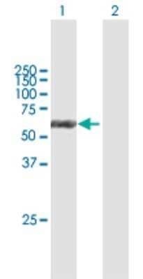 Western Blot: Cytokeratin 6b Antibody [H00003854-B01P] - Analysis of KRT6B expression in transfected 293T cell line by KRT6B polyclonal antibody.  Lane 1: KRT6B transfected lysate(62.04 KDa). Lane 2: Non-transfected lysate.