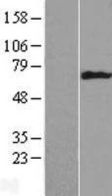 Western Blot Cytokeratin 6b Overexpression Lysate