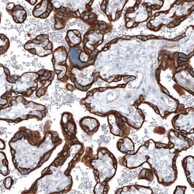 Immunohistochemistry-Paraffin: Cytokeratin 7 Antibody (CL8723) [NBP2-88918] - Staining of human placenta shows strong cytoplasmic positivity in trophoblastic cells.