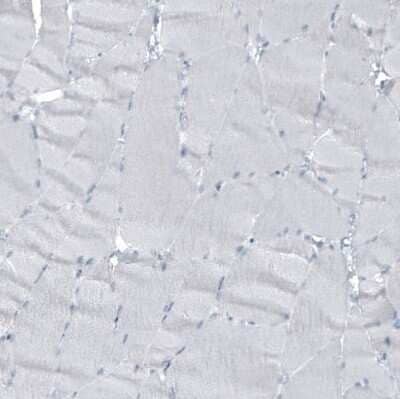 Immunohistochemistry-Paraffin: Cytokeratin 7 Antibody (CL8723) [NBP2-88918] - Staining of human skeletal muscle shows no cytoplasmic positivity in myocytes as expected.