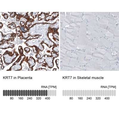 <b>Orthogonal Strategies Validation. </b>Immunohistochemistry-Paraffin: Cytokeratin 7 Antibody (CL8723) [NBP2-88918] - Analysis in human placenta and skeletal muscle tissues using NBP2-88918 antibody. Corresponding KRT7 RNA-seq data are presented for the same tissues.