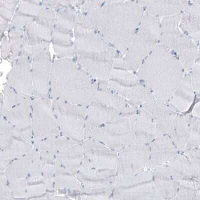 Immunohistochemistry-Paraffin: Cytokeratin 7 Antibody (CL8725) [NBP2-88919] - Staining of human skeletal muscle shows no positivity in myocytes as expected.