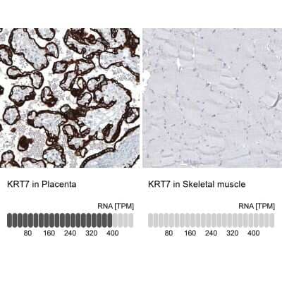 <b>Orthogonal Strategies Validation. </b>Immunohistochemistry-Paraffin: Cytokeratin 7 Antibody (CL8725) [NBP2-88919] - Analysis in human placenta and skeletal muscle tissues using NBP2-88919 antibody. Corresponding KRT7 RNA-seq data are presented for the same tissues.