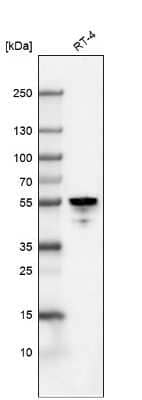 Western Blot: Cytokeratin 7 Antibody (CL8725) [NBP2-88919] - Analysis in human cell line RT-4.