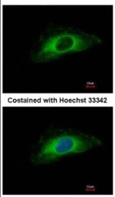 Immunocytochemistry/Immunofluorescence: Cytokeratin 7 Antibody [NBP2-16093] - Immunofluorescence analysis of methanol-fixed HeLa, using antibody at 1:500 dilution.