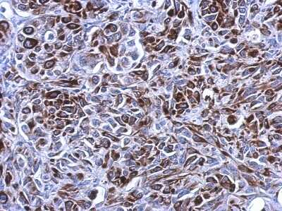 Immunohistochemistry-Paraffin: Cytokeratin 7 Antibody [NBP2-16093] - Immunohistochemical analysis of paraffin-embedded SkHep1 xenograft, using antibody at 1:500 dilution.