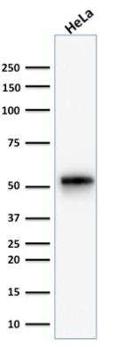 Western Blot: Cytokeratin 7 Antibody (KRT7/1499R) - Azide and BSA Free [NBP2-49881] - Analysis of human HeLa cell lysate using Cytokeratin 7 Rabbit Monoclonal Antibody (KRT7/1499R).