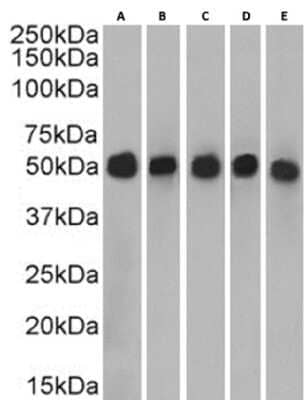 Western Blot: Cytokeratin 7 Antibody (OV-TL 12/30) - Chimeric [NBP3-12014] - HeLa(A) (0.00001ug/ml), HepG2(B) (0.0003ug/ml) and A549(C) (0.00001ug/ml) cell lysate and human thyroid(D) (0.0003ug/ml) and human placenta(E) (0.00001ug/ml) tissue lysate (35ug protein in RIPA buffer) was resolved on a SDS PAGE gel and blots were probed with the chimeric rabbit version of OV-TL 12/30 (NBP3-12014) before detection using an anti-rabbit secondary antibody. A primary incubation of 1h was used and protein was detected by chemiluminescence.