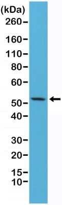 Western Blot: Cytokeratin 7 Antibody (RM284) [NBP2-61525] - Western Blot of HeLa cells lysates using NBP2-61525.