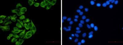 Immunocytochemistry/Immunofluorescence: Cytokeratin 7 Antibody (S03-2E7) [NBP3-19617] - Immunofluorescence of Cytokeratin 7 (green) in Hela using NBP3-19617 at dilution 1/5, and DAPI (blue)