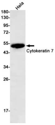 Western Blot: Cytokeratin 7 Antibody (S03-2E7) [NBP3-19617] - Western blot detection of Cytokeratin 7 in Hela cell lysates using NBP3-19617 (1:500 diluted). Predicted band size: 51kDa. Observed band size: 51kDa.