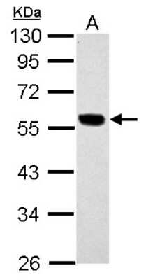 Western Blot: Cytokeratin 7 Antibody [NBP2-16093] - Sample (30 ug of whole cell lysate) A: HeLa 10% SDS PAGE gel, diluted at 1:10000.