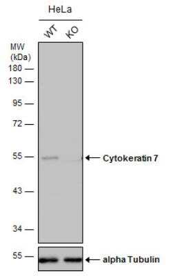 Knockout Validated: Cytokeratin 7 Antibody [NBP2-16093] - Wild-type (WT) and Cytokeratin 7 knockout (KO) HeLa cell extracts (30 ug) were separated by 10% SDS-PAGE, and the membrane was blotted with Cytokeratin 7 antibody [N2C2]. HRP-conjugated anti-rabbit IgG antibody was used to detect the primary antibody.