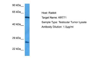 Western Blot: Cytokeratin 71 Antibody [NBP2-86614] - Host: Rabbit. Target Name: KRT71. Sample Tissue: Human Testicular Tumor lysates. Antibody Dilution: 1ug/ml