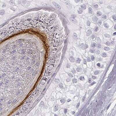 Immunohistochemistry-Paraffin: Cytokeratin 72 Antibody [NBP2-56495] - Staining of human hair shows strong positivity in cuticle layer.