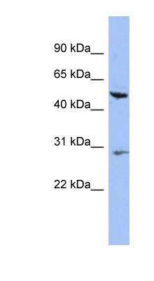 Western Blot: Cytokeratin 75 Antibody [NBP1-55236] - Cytokeratin 75 Antibody HT1080 cell lysate, concentration 0.2-1 ug/ml.