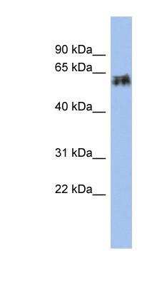 Western Blot: Cytokeratin 75 Antibody [NBP1-55237] - Cytokeratin 75 Antibody Titration: 0.2-1 ug/ml, Positive Control: Human Small Intestine.