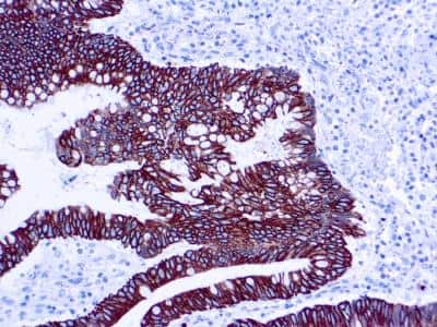 Immunohistochemistry-Paraffin: Cytokeratin 8/18 Antibody (5D3) [NB120-17139] - Formalin fixed paraffin embedded human skin stained with Cytokeratin 8/18 antibody (NB120-17139).