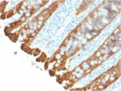 Immunohistochemistry-Paraffin: Cytokeratin 8/18 Antibody (KRT8.18/2297R) - Azide and BSA Free [NBP3-08918] - Formalin fixed paraffin embedded human colon stained with Cytokeratin 8/18 Rabbit Recombinant Monoclonal Antibody (KRT8.18/2297R).