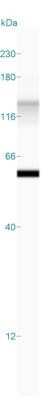 Simple Western: Cytokeratin 8/18 Antibody (KRT8/803 + KRT18/835) - Azide and BSA Free [NBP2-47983] - Simple Western lane view shows a specific band for Cytokeratin 8/18 in 0.2 mg/ml of A431 lysate. This experiment was performed under reducing conditions using the 12-230 kDa separation system.