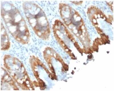 Immunohistochemistry-Paraffin: Cytokeratin 8/18 Antibody (rKRT8.18/1346) - Azide and BSA Free [NBP3-08300] - Formalin-fixed, paraffin-embedded human colon stained with Cytokeratin 8/18 Mouse Recombinant Monoclonal Antibody (rKRT8.18/1346).