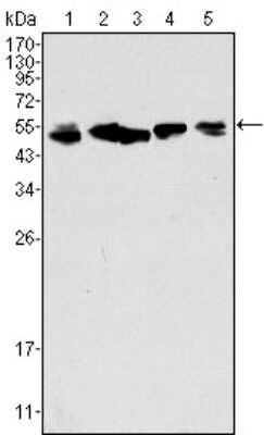 Western Blot: Cytokeratin 8 Antibody (8A5D12) [NBP1-47533] - Analysis using CK8 mouse mAb against A549 (1), Hela (2), MCF-7 (3), A431 (4) and HepG2 (5) cell lysate.